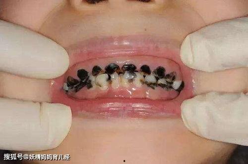 水瓜怎么样做不黑牙齿吃,轻松保持牙齿洁白不黑